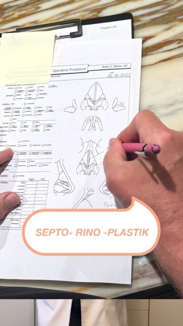 ✨Komplexe Nasenchirurgie – sichtbar gemacht✨ Gerade bei anspruchsvollen Eingriffen wie der Septorhinoplastik hilft eine schematische Zeichnung, operative Veränderungen klar festzuhalten. Sie ergänzt die Dokumentation, macht chirurgische Entscheidungen nachvollziehbar und unterstützt die präzise Nachbereitung des Eingriffs. Ein fester Bestandteil unserer chirurgischen Arbeitsweise. ✨ Habt ihr noch Fragen? Schreibt sie uns in die Kommentare. #septorhinoplasty #faceliftdoc #noahklinik #kassel #plasticsurgery
