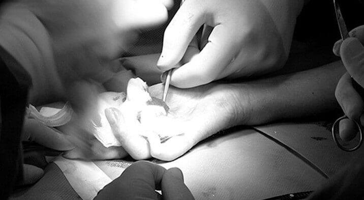 In safe hands - hand surgery at the Noah Clinic