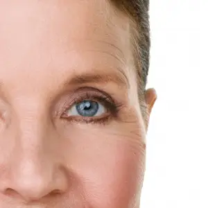 Radiant look thanks to eyelid lift in Kassel