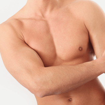 Gynaecomastia - male breast removal in Kasel