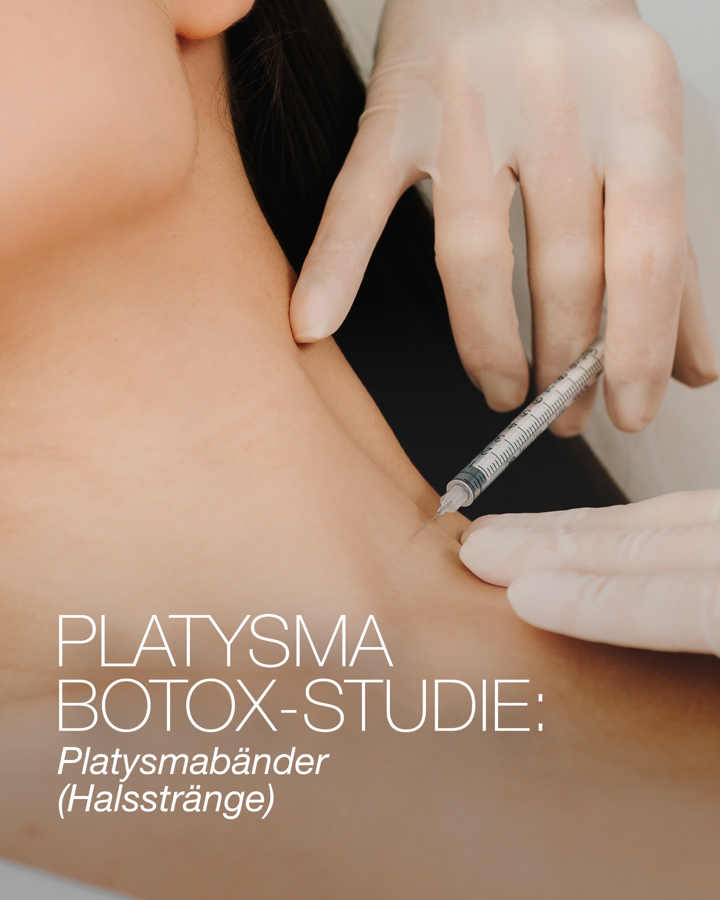 Platysma-Botox-Studie 🧬✨ Glattere Halspartie, weniger sichtbare Halsstränge – wissenschaftlich begleitet. Wir suchen Teilnehmer:innen für unsere Platysma-Botox-Studie (Halsstränge). Interesse? Die Studien-Mail finden Sie im letzten Slide 📩 Weitere Infos folgen.