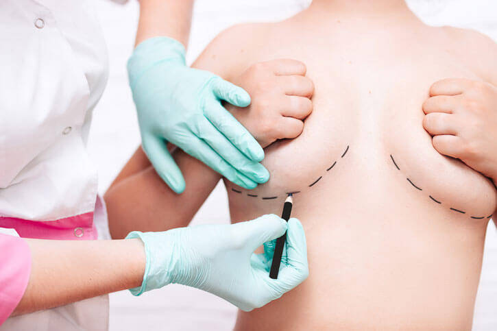 Will breast implants fill loose skin? - Aesthetic Surgical Images