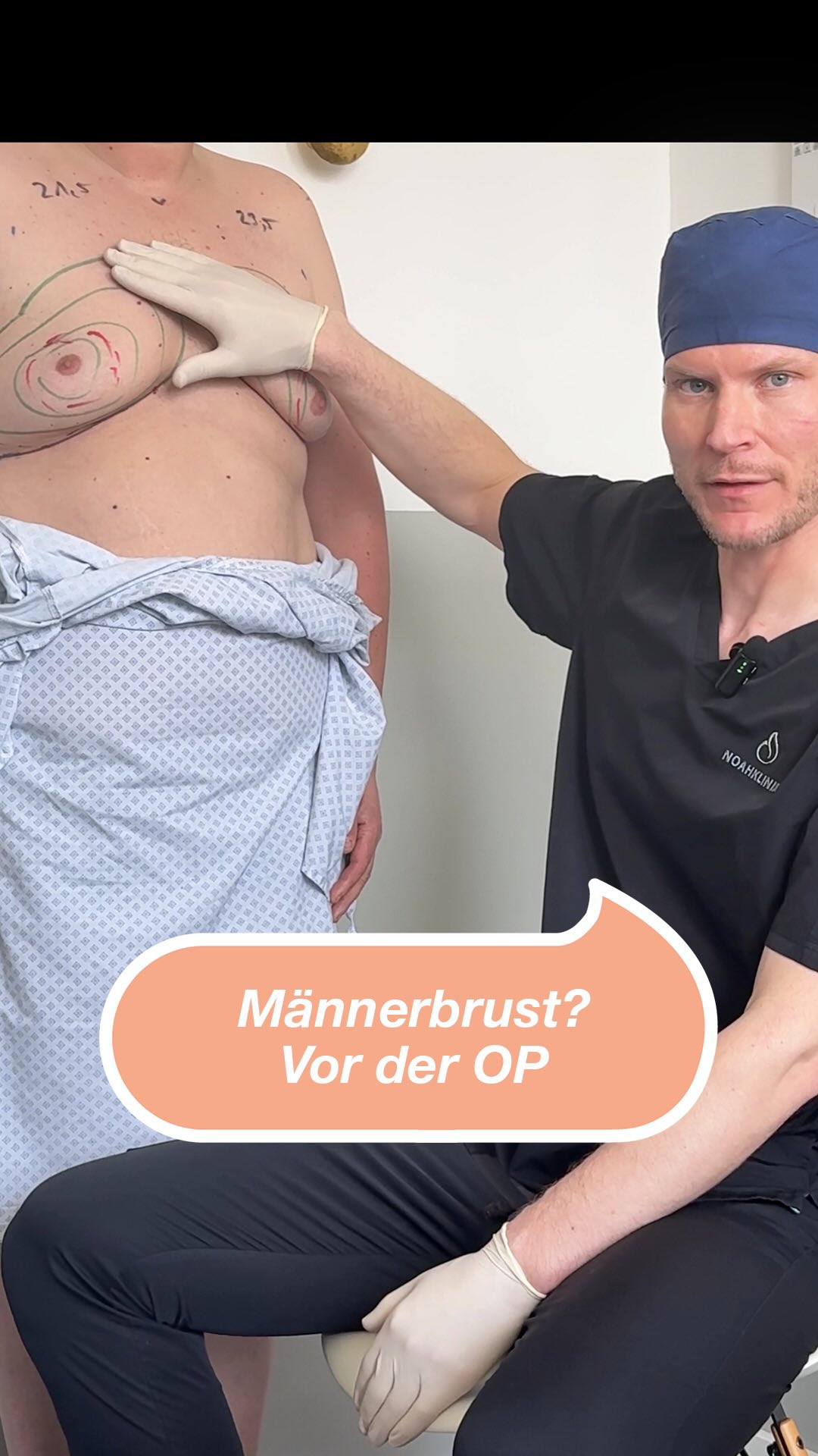 Männerbrust – was tun? Dr. Eric Klingelhöfer zeigt direkt am Patienten, wie bei einer Gynäkomastie vorgegangen wird und erklärt die einzelnen Schritte der Behandlung. Transparenz, Aufklärung und individuelle Lösungen stehen bei uns im Fokus. #gynäkomastie #maennerbrust #noahklinik #quantumtechnologie #plastischechirurgie